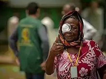 Woman walking in a street, wearing an adhesive patch over her right eye