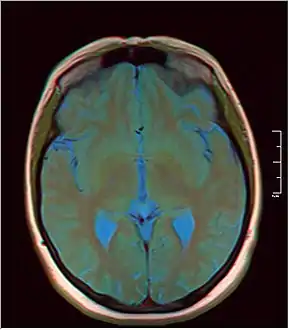 MRI axial in false color