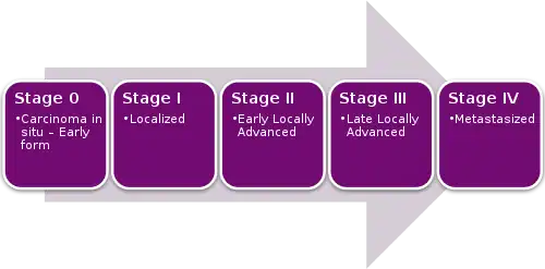 Cancer Stages