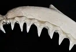 Upper teeth