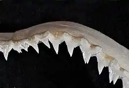 Upper teeth