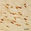 Micrograph of cholinergic neurons in the nucleus basalis of a rhesus monkey; Bar = 50 microns (0.05 millimeters).