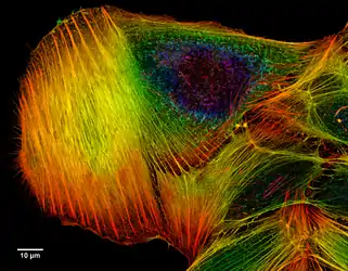 Colour coded image of actin filaments in a cancer cell.