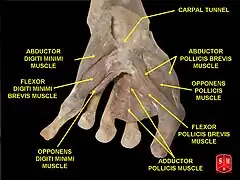 Opponens pollicis muscle