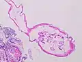 Partially longitudinal cross-section of Enterobius vermicularis, H&E stain