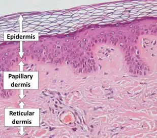 Epidermis, papillary dermis and reticular dermis.