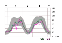 TSNIT graph