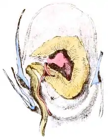 Heart surrounded by tringular kidney. One retractor muscle is depicted on the right and two ones are one the left.