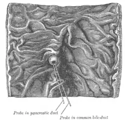 Interior of the descending portion of the duodenum, showing bile papilla.