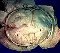 Human brain dura mater