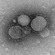 Electron micrograph of MERS-CoV.