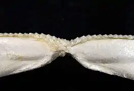 Lower teeth