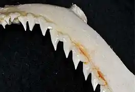 Upper teeth