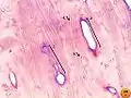 Bone by decalcification (100x): Volkmann's canalHaversian canalLacunaLamella