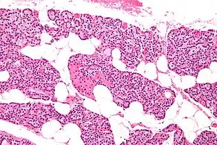 Intermediate magnification micrograph. H&E stain. The white round structures are fat cells. Adipose tissue comprises 25–40% of normal parathyroid gland tissue.