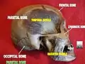 Parietal bone