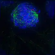 Early prometaphase: The nuclear membrane has just disassembled, allowing the microtubules to quickly interact with the kinetochores, which assemble on the centromeres of the condensing chromosomes.