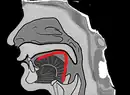 The shape of tongue when pronouncing ㄱ