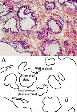 Microscopic glands of the prostate