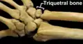 Right hand posterior view (dorsal view). Thumb on bottom.