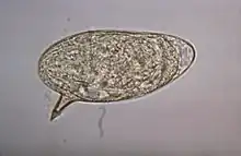 Schistosoma mansoni