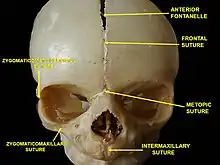 Human baby skull.  Anterior view.