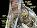 Lumbar and sacral plexus. Deep dissection.Anterior view.