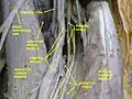 Femoral artery - deep dissection.