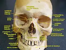 Perpendicular plate of Ethmoid.