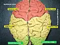 Occipital lobe