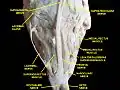 Extrinsic eye muscle. Nerves of orbita. Deep dissection.