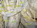 Ascending aorta