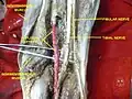 Tibial nerve