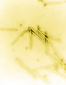 Electron micrograph of rod shaped TMV particles