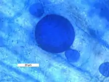 Bilayered glomoid spore of arbuscular mycorrhizal fungi in the root of Horse Gram