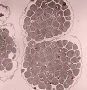 Stained cross-section of ripe ovary full of ova